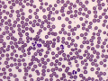 Well-stained smear