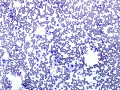 Panleukopenia