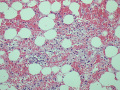 Panleukopenia (marrow H&E)