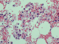 Panleukopenia (marrow H&E)