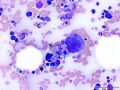 Erythrophage & megakaryocyte