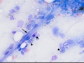 Vessel & mast cell