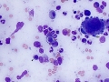 Precursor-directed immune-mediated anemia (PIMA, canine)