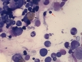 Erythrophagia with FIP (feline)