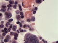 Megakaryocyte & erythrophage (feline, FIP, H&E)