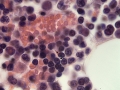Lymphocytes (feline, FIP H&E)