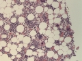 Megakaryocytic dysplasia (feline, FIP, H&E)