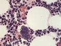 Megakaryocyte & erythrophage (feline, FIP, H&E)
