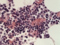 Lymphocytes (feline, FIP, H&E)