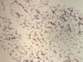 Hypocellular (feline, FIP, H&E)