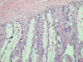 Panleukopenia (ileum, H&E)