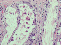Panleukopenia (ileum, H&E)