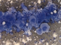 Megakaryocytic hyperplasia