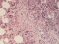 Erythroid & myeloid areas (H&E)