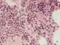 Erythroid-rich area (H&E)