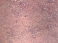 PIMA (canine, H&E)