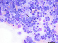 Mott cell (PIMA)