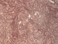 PIMA (canine, reticulin)