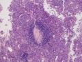 PRCA (feline, H&E)