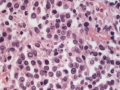 Autolysis (H&E)