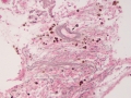 PIMA (canine, reticulin)