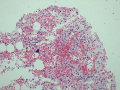Panleukopenia (marrow H&E)