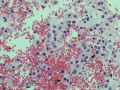 Panleukopenia (marrow H&E)