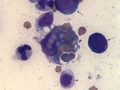Hemophagocytic lymphohistiocytosis (cat)