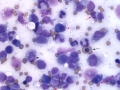 Hemophagocytic lymphohistiocytosis (cat)