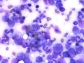 Hemophagocytic lymphohistiocytosis (cat)