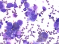 Hemophagocytic lymphohistiocytosis (cat)