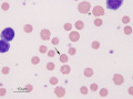 Anaplasma marginale