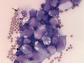 Lymphoma (goat)