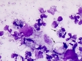Septic pleuritis (bovine)