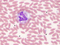 <i>Mycoplasma haemalamae</i>