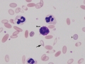 Neutrophils & basophil