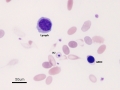 Lymphocyte & nRBC