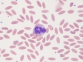 Eosinophil