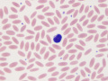 Lymphocyte