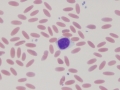 Lymphocyte