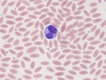 Monocyte