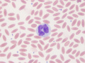 Monocyte