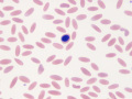 Metarubricyte