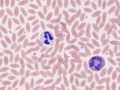 Neutrophil & eosinophil