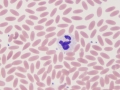 Neutrophil