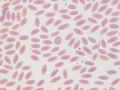 Polychromatophil