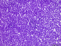 Overstain