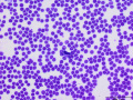 Overstain
