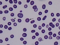 Babesia canis