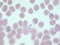 Babesia canis